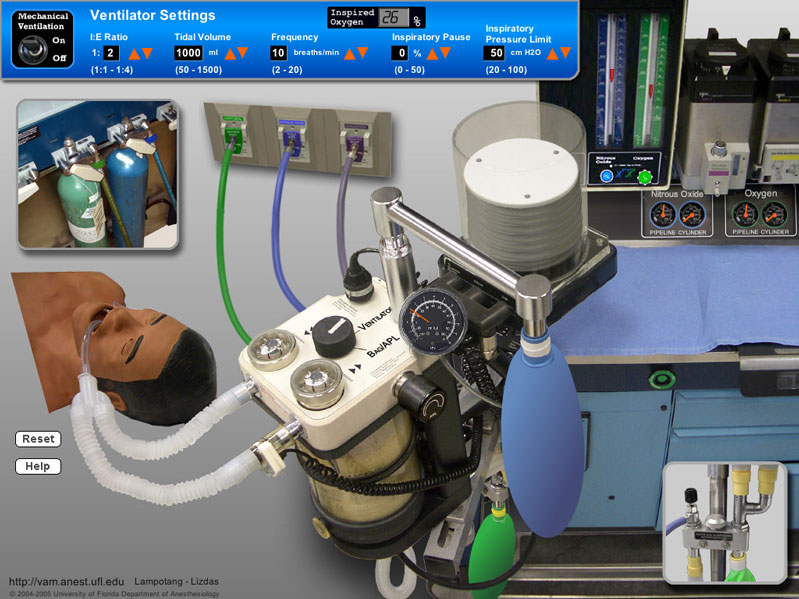 Opaque "black box" simulation of an anesthesia machine 