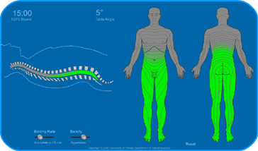 Spinal Anesthesia Simulation